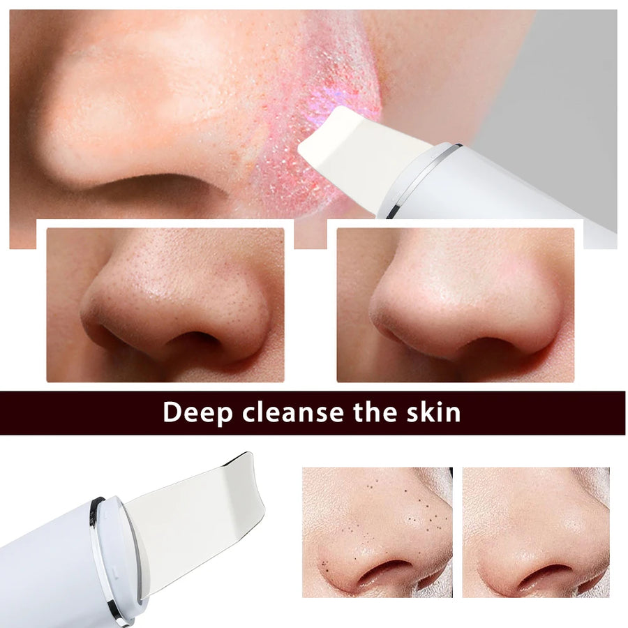 Ultrasonic Skin Scrubber | 4-Mode Blackhead Remover & Facial Deep Cleanser