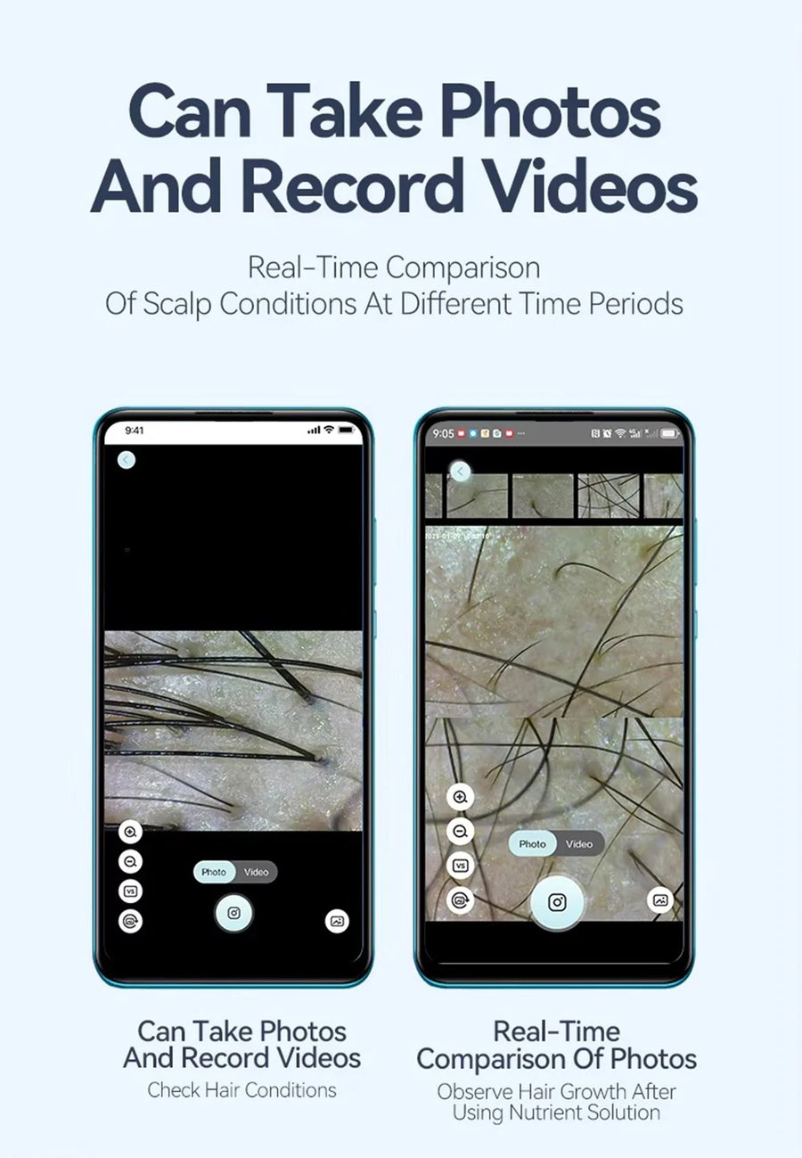 New 50X-200X Magnifying Hair Follicles Scalp Detector Skin Analyzer Microscope Tool High Definition Skin Tester Support APP
