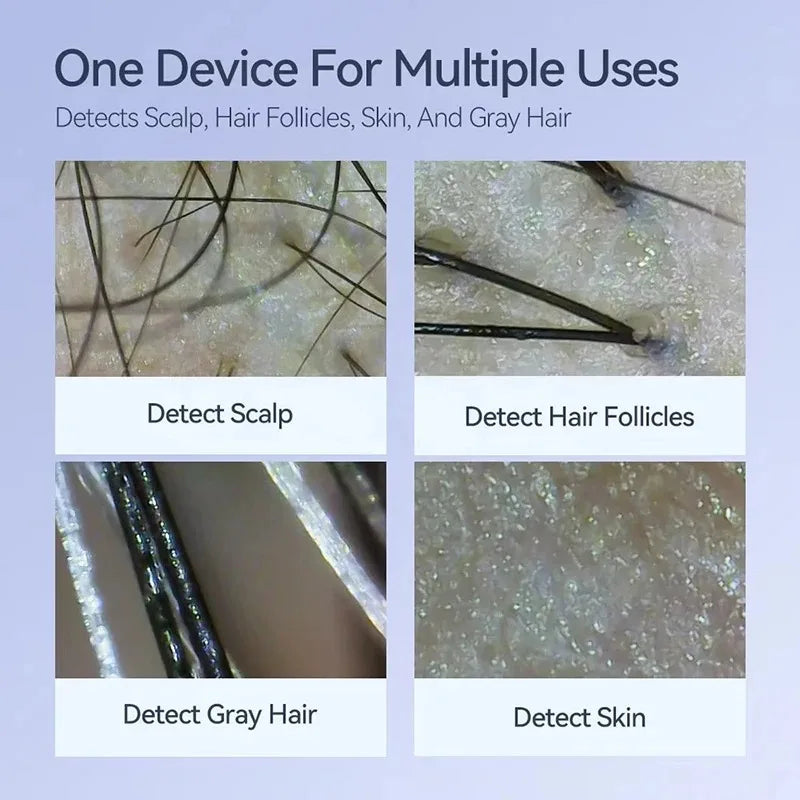 New 50X-200X Magnifying Hair Follicles Scalp Detector Skin Analyzer Microscope Tool High Definition Skin Tester Support APP