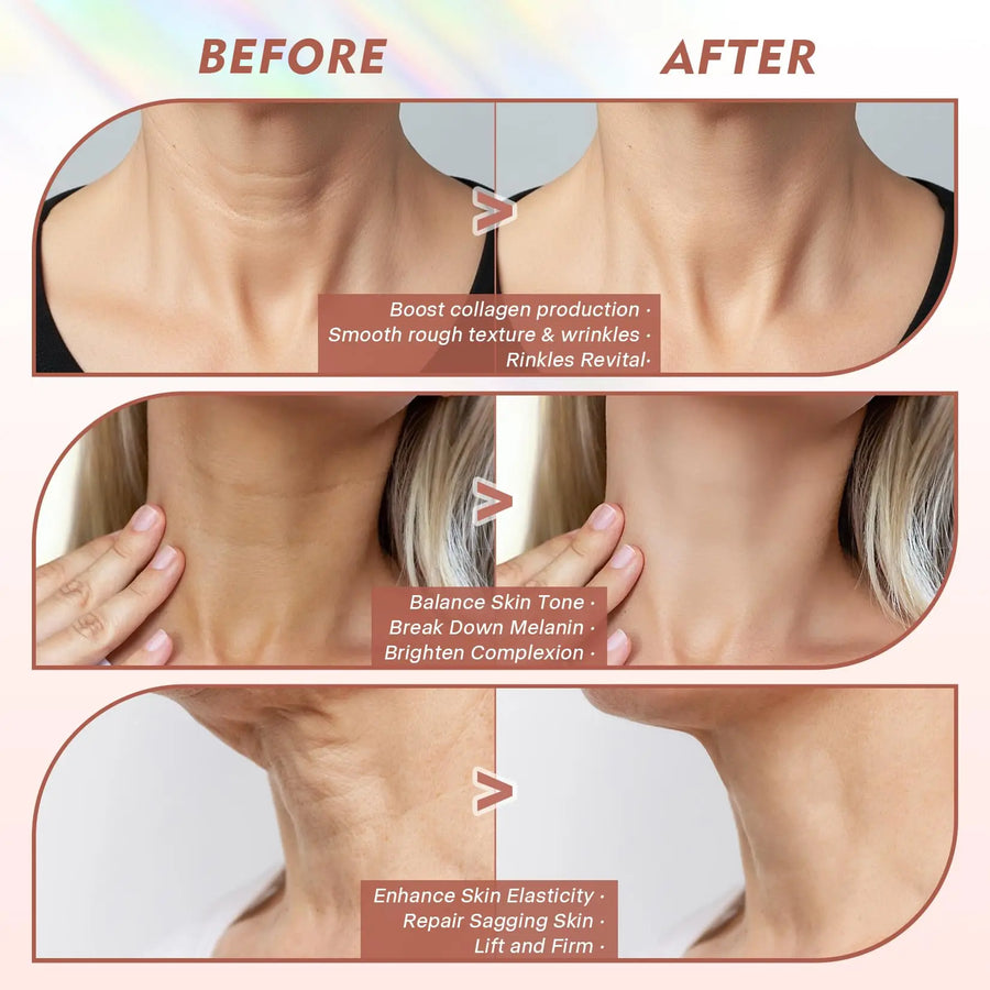 LED Neck Lift Mask | Photon Anti-Wrinkle Skin Tightening | Red & Blue Light Therapy