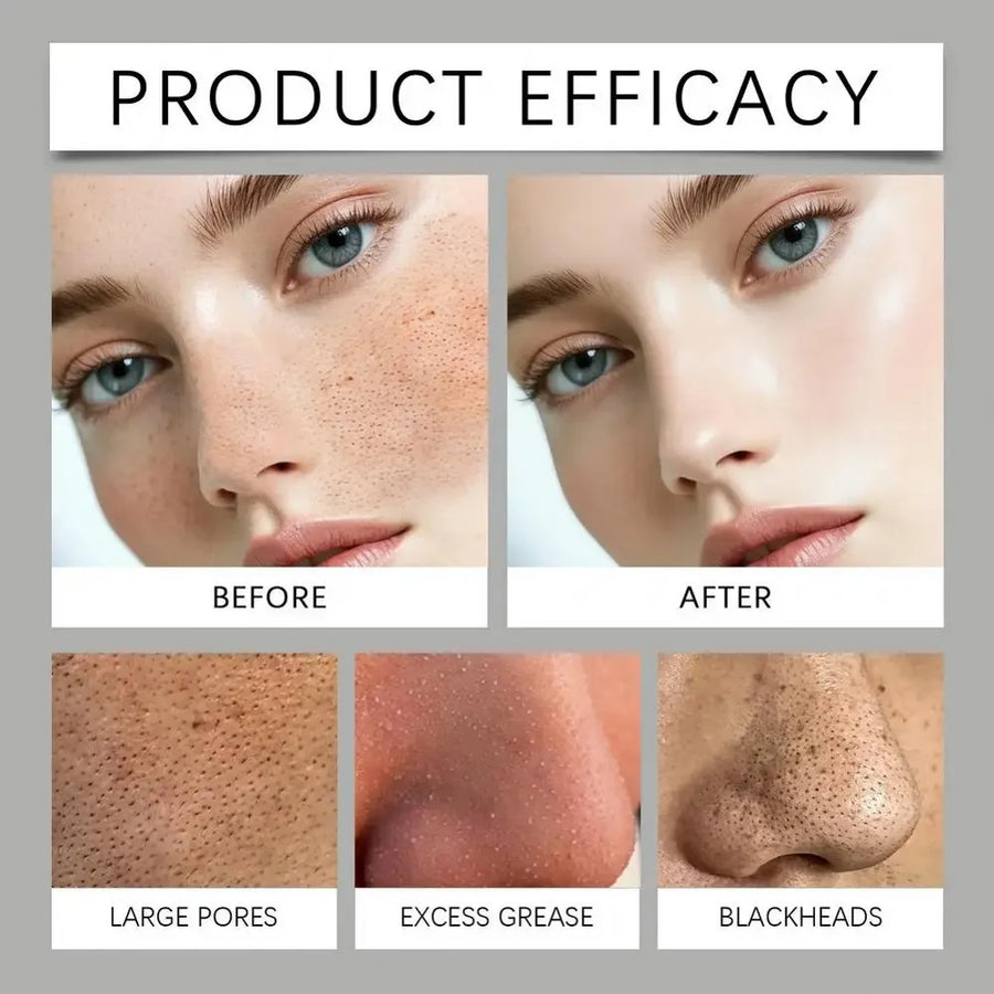 Face Skin Care Tools Electric Blackhead Remover Vacuum Cleaner Black Spots Removal Facial Deep Cleansing Pore Cleaner Machine