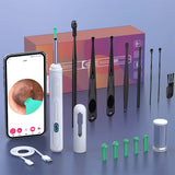NATFIRE NK3 Pro Visual Ear Cleaner | 1296P HD Camera | WiFi Otoscope