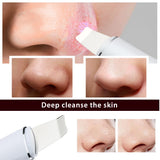 Ultrasonic Skin Scrubber | 4-Mode Blackhead Remover & Facial Deep Cleanser