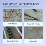 New 50X-200X Magnifying Hair Follicles Scalp Detector Skin Analyzer Microscope Tool High Definition Skin Tester Support APP