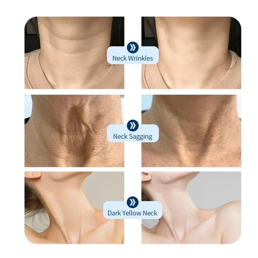 LED Neck Lift Mask | Photon Anti-Wrinkle Skin Tightening | Red & Blue Light Therapy