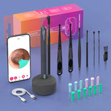 NATFIRE NK3 Pro Visual Ear Cleaner | 1296P HD Camera | WiFi Otoscope