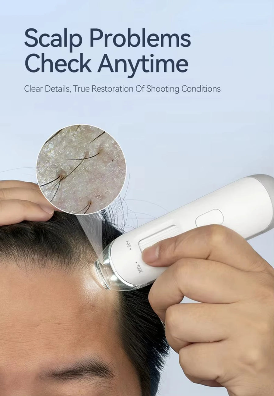 New 50X-200X Magnifying Hair Follicles Scalp Detector Skin Analyzer Microscope Tool High Definition Skin Tester Support APP