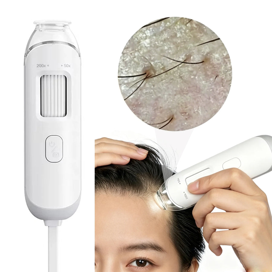 New 50X-200X Magnifying Hair Follicles Scalp Detector Skin Analyzer Microscope Tool High Definition Skin Tester Support APP