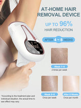 IPL Hair Removal Device | 999,900 Flashes | Painless & Permanent | For Women & Men
