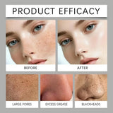 Face Skin Care Tools Electric Blackhead Remover Vacuum Cleaner Black Spots Removal Facial Deep Cleansing Pore Cleaner Machine